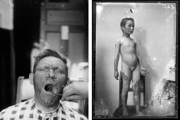 Nezināma autora fotogrāfijas, atrastas Talsu leprozorijas noliktavā