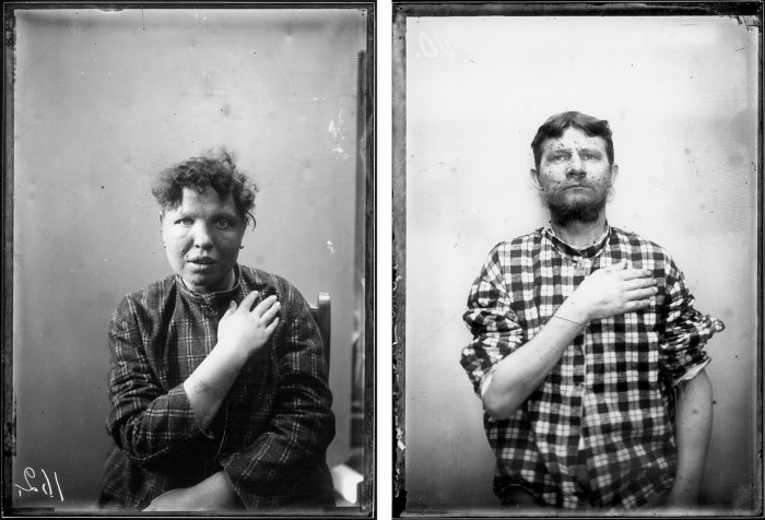 Nezināma autora fotogrāfijas, atrastas Talsu leprozorijas noliktavā